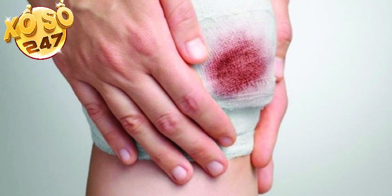 Lưu ý quan trọng khi giải mã giấc mơ chó cắn chân