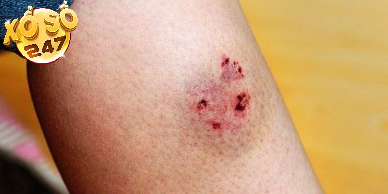 Mơ chó lạ cắn vào chân đánh 64, 88